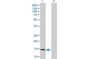 Western Blot analysis of RARRES2 expression in transfected 293T cell line by RARRES2 MaxPab polyclonal antibody. (Chemerin antibody  (AA 1-163))