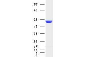 Western Blotting (WB) image for Coronin, Actin Binding Protein, 1B (CORO1B) (Transcript Variant 1) protein (Myc-DYKDDDDK Tag) (ABIN2712512)