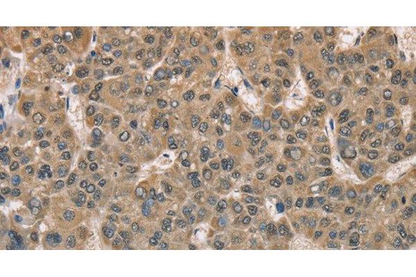 DACH2 antibody