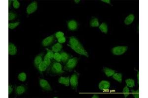 Image no. 4 for anti-Non-SMC Condensin I Complex, Subunit D2 (NCAPD2) (AA 1240-1339) antibody (ABIN599100) (NCAPD2 antibody  (AA 1240-1339))