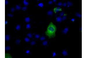 Image no. 8 for anti-Lipase, Endothelial (LIPG) antibody (ABIN1499164) (LIPG antibody)