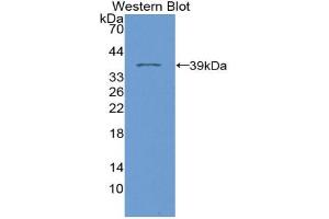 Western blot analysis of the recombinant protein. (Phospholamban antibody  (AA 1-52))