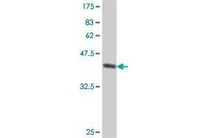 Western Blot detection against Immunogen (37. (Plexin B2 antibody  (AA 1506-1611))