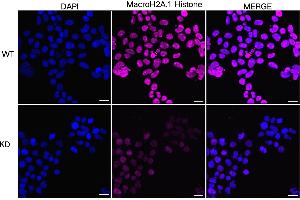 Immunocytochemical staining of HeLa cells using MacroH2A. (Recombinant Histone, H2A1, Macro antibody)