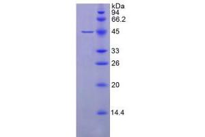 SDS-PAGE analysis of Human GPX4 Protein.