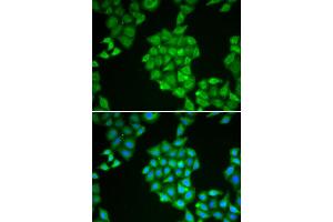 Immunofluorescence analysis of HeLa cell using EPPIN antibody. (Eppin antibody)