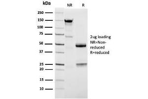 SDS-PAGE Analysis Purified Napsin A Mouse Monoclonal Antibody (NAPSA/3309). (NAPSA antibody  (AA 189-299))