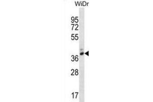 Western Blotting (WB) image for anti-Pepsinogen 4, Group I (Pepsinogen A) (PGA4) antibody (ABIN2995157) (PGA4 antibody)