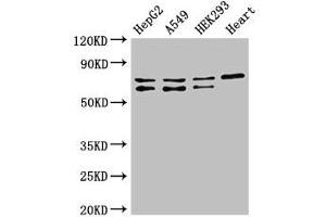 Western Blot Positive WB detected in: HepG2 whole cell lysate, A549 whole cell lysate, HEK293 whole cell lysate, Mouse heart tissue All lanes: HIF3A antibody at 2. (HIF3A antibody  (AA 516-669))