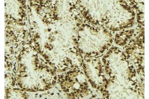 ABIN6273114 at 1/100 staining Human lung tissue by IHC-P.