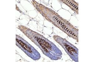 IHC analysis of Cytokeratin 1/Krt1 using anti-Cytokeratin 1/Krt1 antibody (ABIN7600713).