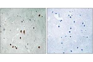 Immunohistochemistry analysis of paraffin-embedded human brain, using CNOT2 (Phospho-Ser101) Antibody.