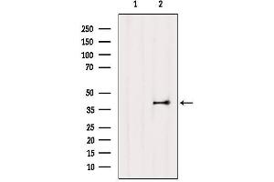 Western blot analysis of extracts from Mouse lung, using EDG3 Antibody. (S1PR3 antibody  (N-Term))