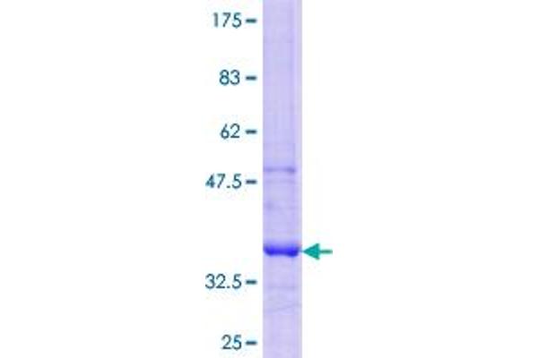 GCNT3 Protein (AA 28-126) (GST tag)