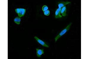 IF analysis of PDE6 beta/PDE6B using anti-PDE6 beta/PDE6B antibody (ABIN7600893). (PDE6B antibody  (AA 25-237))