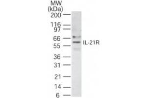 Image no. 1 for anti-Interleukin 21 Receptor (IL21R) (AA 65-80) antibody (ABIN208550)