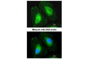 Figure 1. (CRYbA4 antibody  (N-Term))