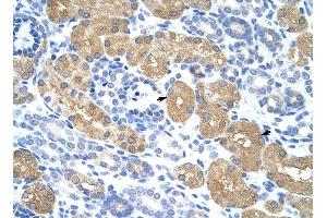 RAE1 antibody was used for immunohistochemistry at a concentration of 4-8 ug/ml to stain Epithelial cells of renal tubule (arrows) in Human Kidney.