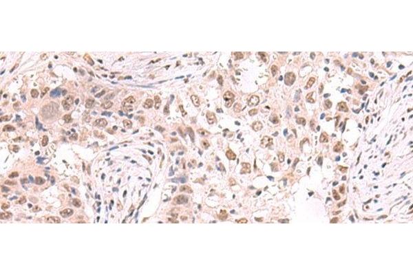 ZNF559 antibody