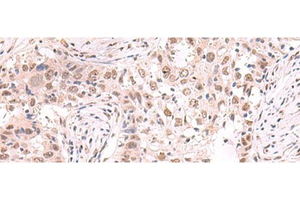 ZNF559 anticorps