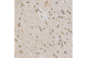 Immunohistochemistry of paraffin-embedded rat brain tissue using H3K79me3 antibody at dilution of 1:200 (x400 lens). (Histone 3 antibody  (H3K79me3))