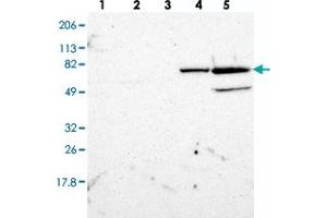 Western blot analysis of Lane 1: RT-4, Lane 2: U-251 MG, Lane 3: A-431, Lane 4: Liver, Lane 5: Tonsil with ZNF234 polyclonal antibody  at 1:250-1:500 dilution.
