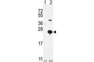 Western Blotting (WB) image for anti-Epithelial Mitogen (EPGN) antibody (ABIN2996100) (Epigen antibody)