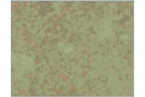 Immunohistochemistry analysis of Listeria infected mice spleens 6 days after infection with L-monocytogenes using AM03145PU (Clone LK2). (HSPD1 antibody)