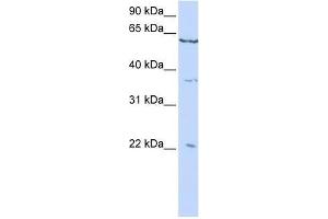 CSRP2 antibody used at 0. (CSRP2 antibody  (C-Term))