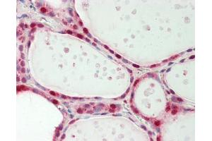 Human Thyroid: Formalin-Fixed, Paraffin-Embedded (FFPE) (EIF4A3 antibody  (AA 1-50))