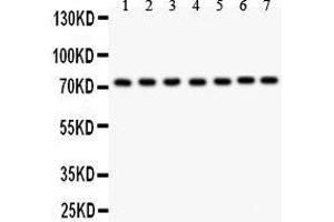 Anti- GCLC antibody, Western blotting All lanes: Anti GCLC  at 0. (GCLC antibody  (AA 437-637))