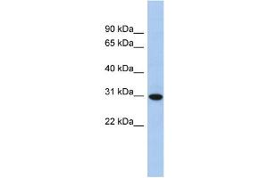 WB Suggested Anti-TMED8 Antibody Titration: 0. (TMED8 antibody  (Middle Region))