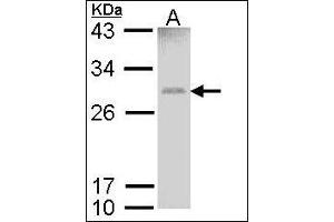 Sample (30 µg of whole cell lysate). (GSTM1 antibody)