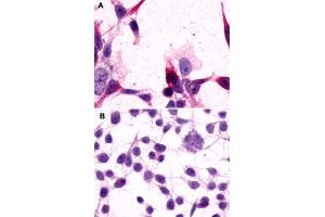 Immunocytochemistry (ICC) staining of HEK293 human embryonic kidney cells transfected (A) or untransfected (B) with GRM3. (Metabotropic Glutamate Receptor 3 antibody  (Extracellular Domain))