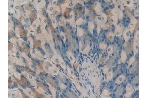 Detection of HAO1 in Mouse Stomach Tissue using Polyclonal Antibody to Hydroxyacid Oxidase 1 (HAO1) (HAO1 antibody  (AA 113-369))