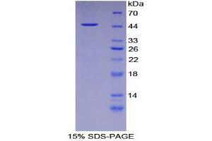 SDS-PAGE (SDS) image for Desmoglein 3 (DSG3) (AA 858-999) protein (His tag,GST tag) (ABIN2122748)
