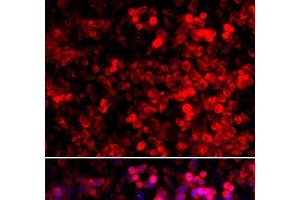 Immunofluorescence analysis of U2OS cells using QARS Polyclonal Antibody