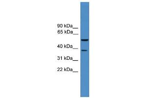 WB Suggested Anti-Bace1 Antibody Titration: 0. (BACE1 antibody  (Middle Region))