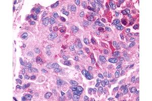 Immunohistochemistry (IHC) image for anti-G Protein-Coupled Receptor 27 (GPR27) (C-Term) antibody (ABIN1048787)
