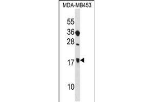 Western blot analysis in MDA-MB453 cell line lysates (35ug/lane). (SIT1 antibody  (C-Term))