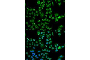 Immunofluorescence analysis of U2OS cells using LMNB2 antibody (ABIN5973877). (Lamin B2 antibody)
