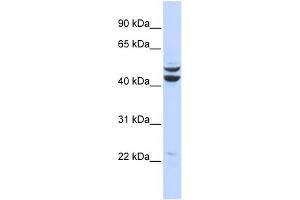 WB Suggested Anti-PKNOX2 Antibody Titration:  0. (PKNOX2 antibody  (Middle Region))