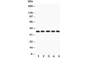 Western blot testing of LOX-1 antibody and Lane 1:  rat liver;  2: human HeLa;  3: (h) K562;  4: (h) Raji lysate.