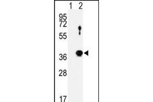 Western blot analysis of NEK6 (arrow) using rabbit polyclonal NEK6 Antibody (N-term) (ABIN1882104 and ABIN2842153).