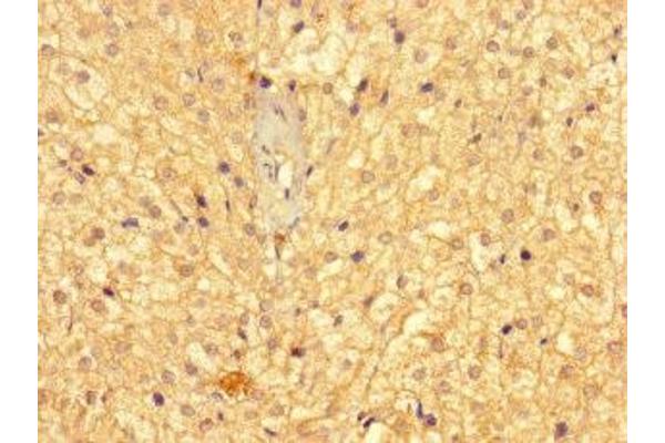 GMPPB antibody  (AA 61-360)