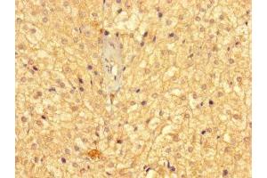 Immunohistochemistry of paraffin-embedded human adrenal gland tissue using ABIN7158978 at dilution of 1:100 (GMPPB antibody  (AA 61-360))