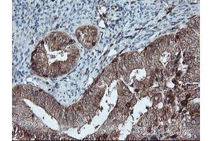 Image no. 2 for anti-LIM Domain Kinase 1 (LIMK1) antibody (ABIN1499146) (LIM Domain Kinase 1 antibody)