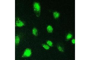 IF analysis of KBTBD2 using anti-KBTBD2 antibody (ABIN6719647). (KBTBD2 antibody)