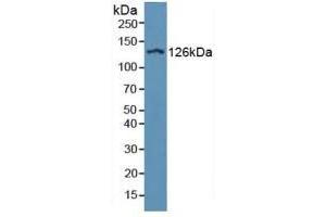 Figure. (ITGAD antibody  (AA 879-1099))