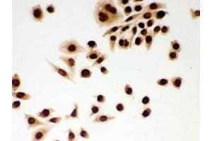 Immunocytochemistry (ICC) image for anti-Damage Specific DNA Binding Protein 1 (DDB1) (AA 1011-1140) antibody (ABIN4950780)